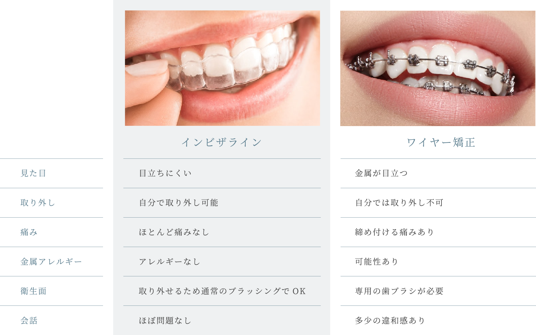 ワイヤー矯正との違い