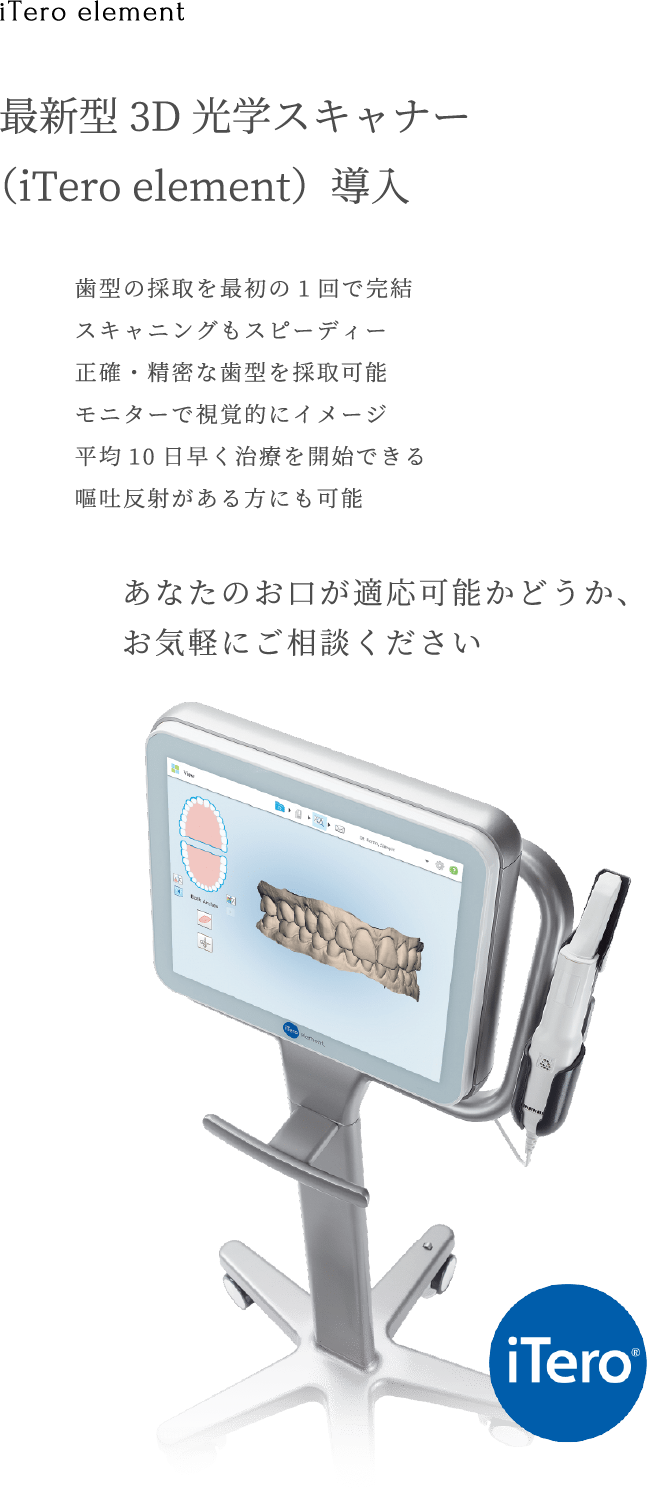 最新型3D高額スキャナー